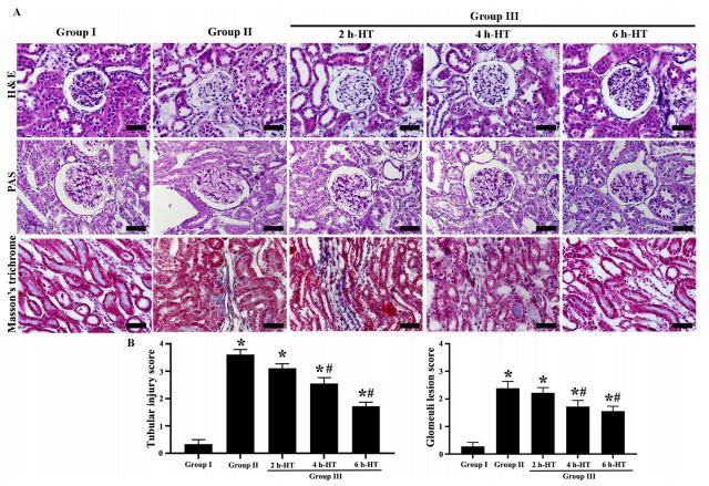 Figure 5. Histology of renal tissues in each group.