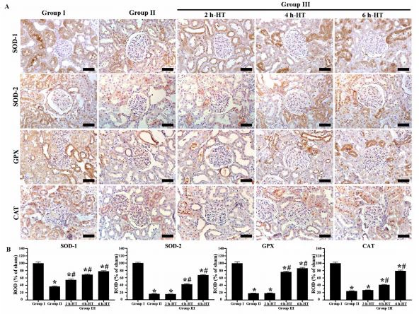 Figure 6. Immunohistochemistry analysis of antioxidant enzyme expression in renal cortex tissue.